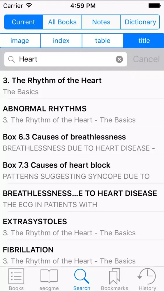 The ECG Made Easy, 8th Edition Screenshots