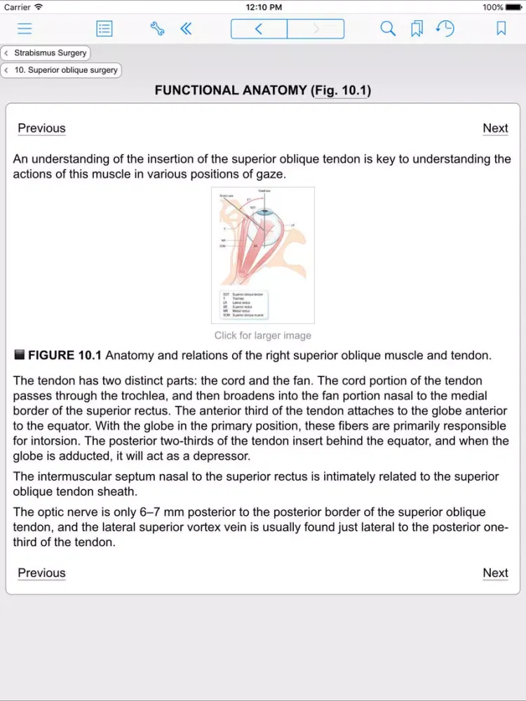 Zrzuty ekranu Strabismus Surgery iPad 