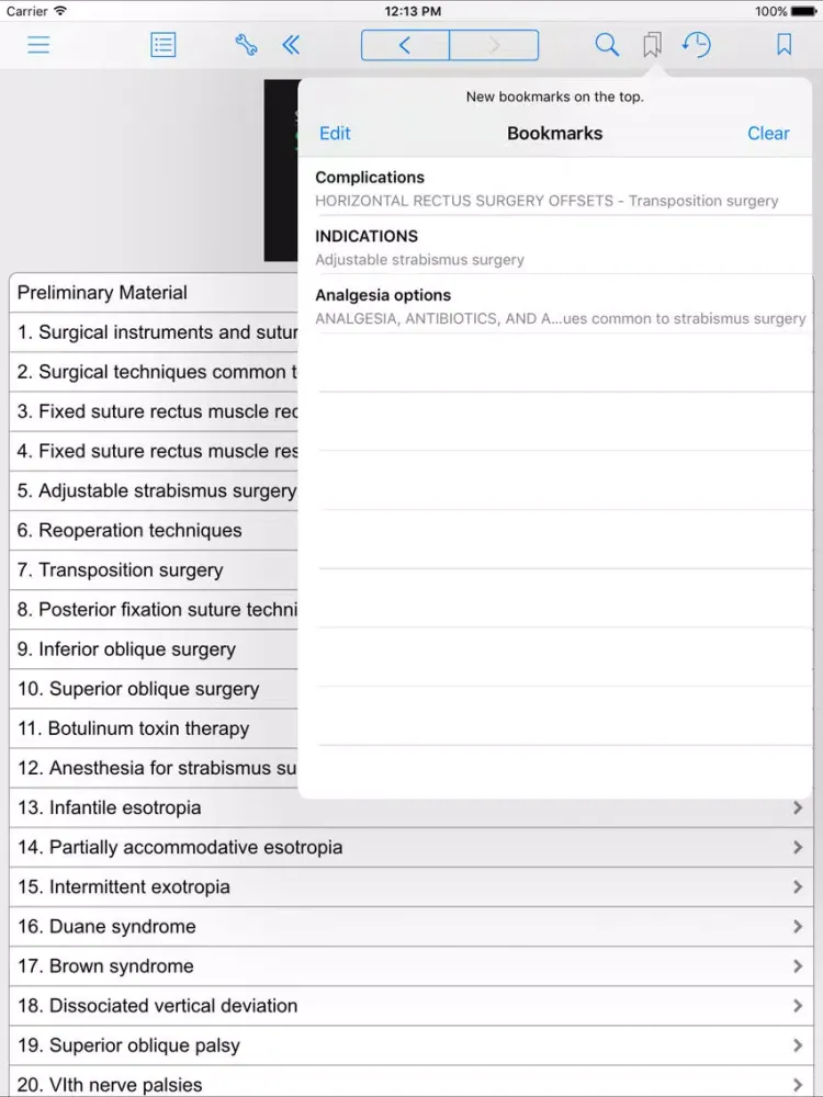 Zrzuty ekranu Strabismus Surgery iPad 
