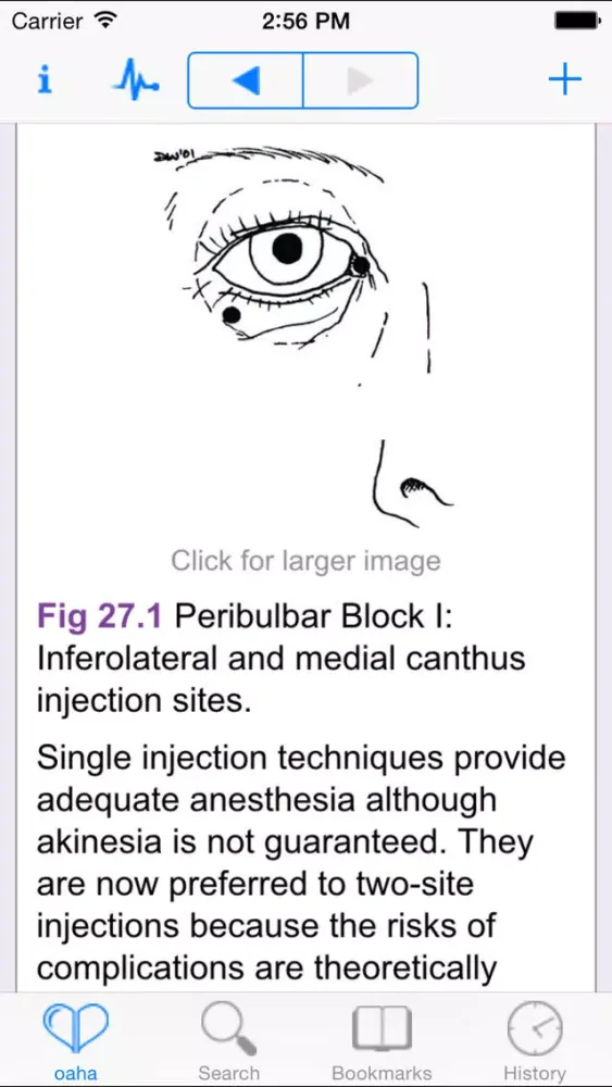 OA Handbook of Anesthesiology应用截图