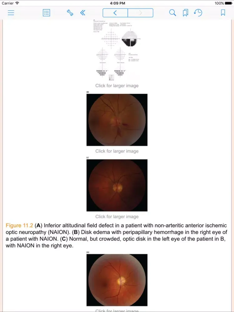 Tangkapan skrin Mount Sinai Expert Guides: Neurology (FREE Sample) iPad 