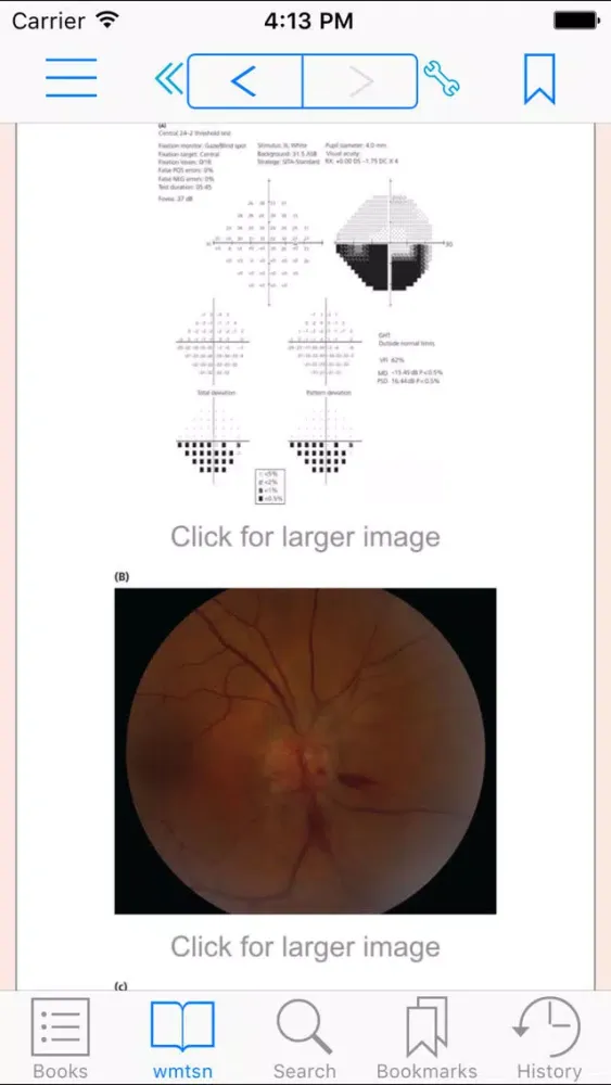 Tangkapan skrin Mount Sinai Expert Guides: Neurology (FREE Sample)