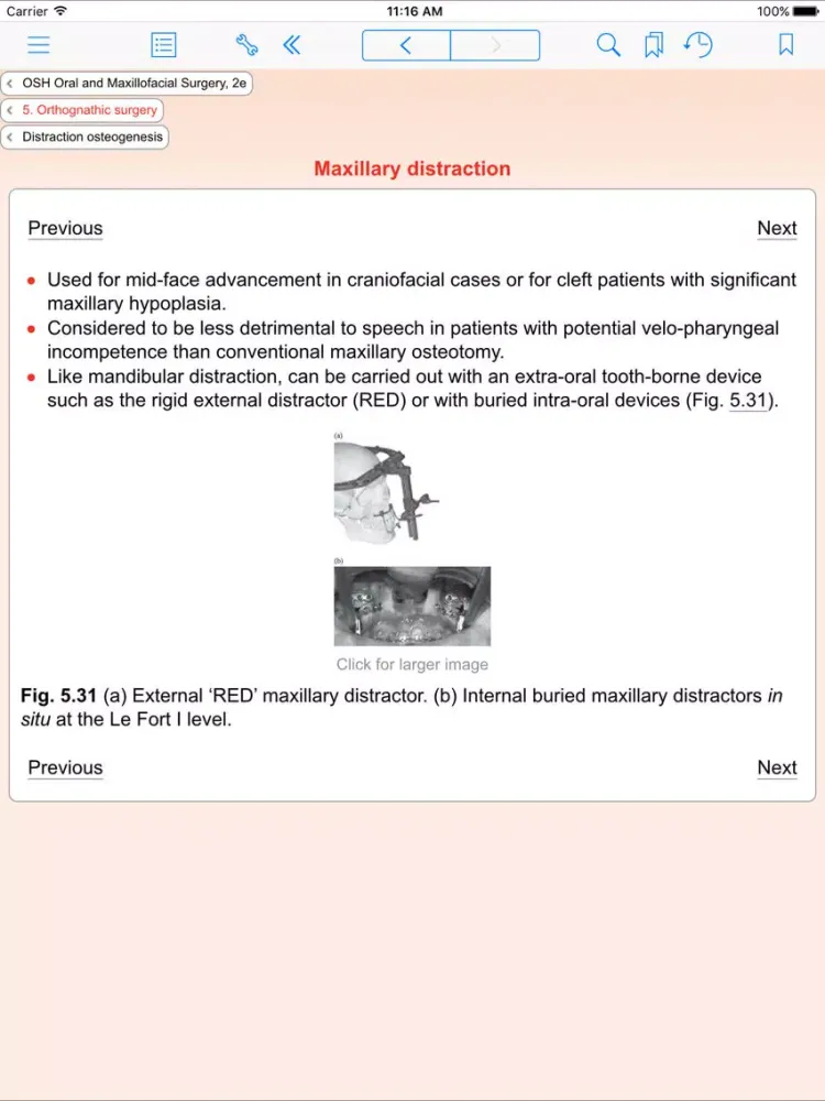 Oral and Maxillofacial Surgery, Second Edition iPad  स्क्रीनशॉट