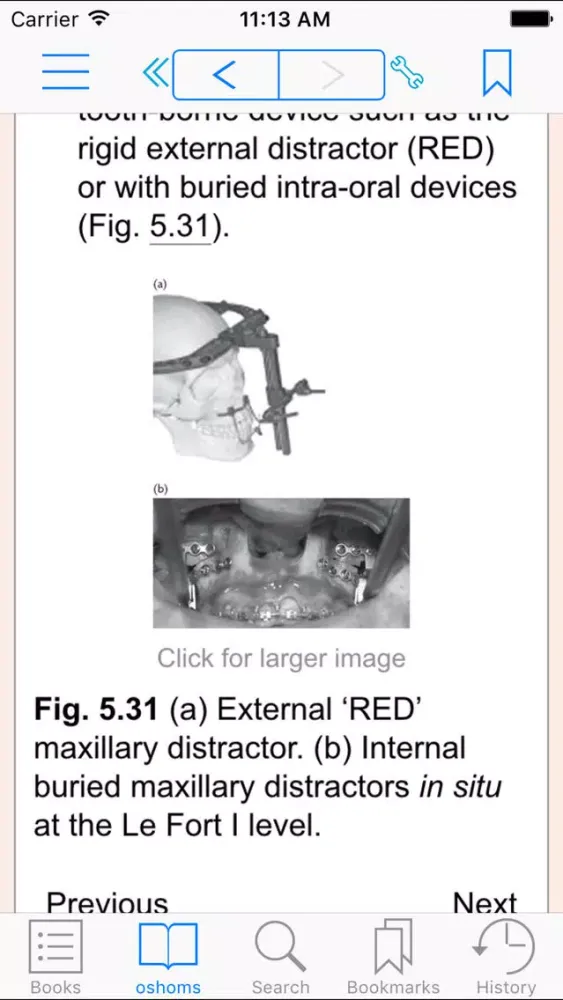 Oral and Maxillofacial Surgery, Second Edition स्क्रीनशॉट