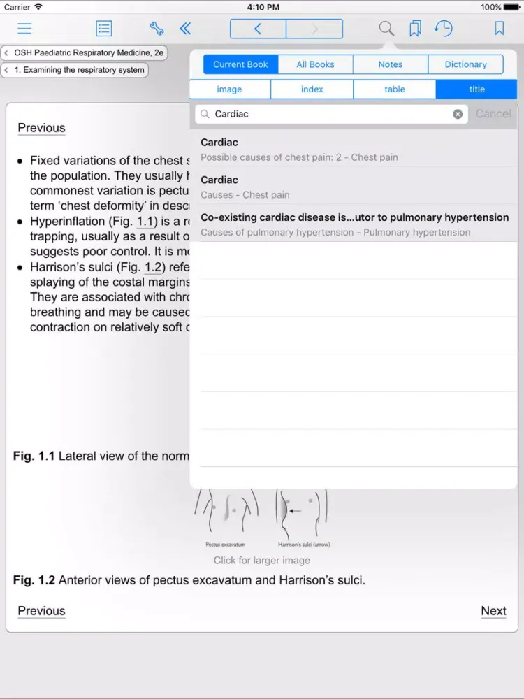 Paediatric Respiratory Medicine, second edition iPad  স্ক্রিনশট