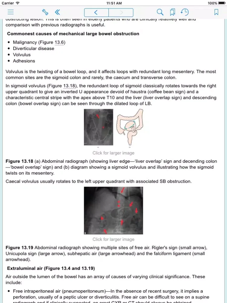 ABC of Emergency Radiology, 3rd Edition iPad  Screenshots