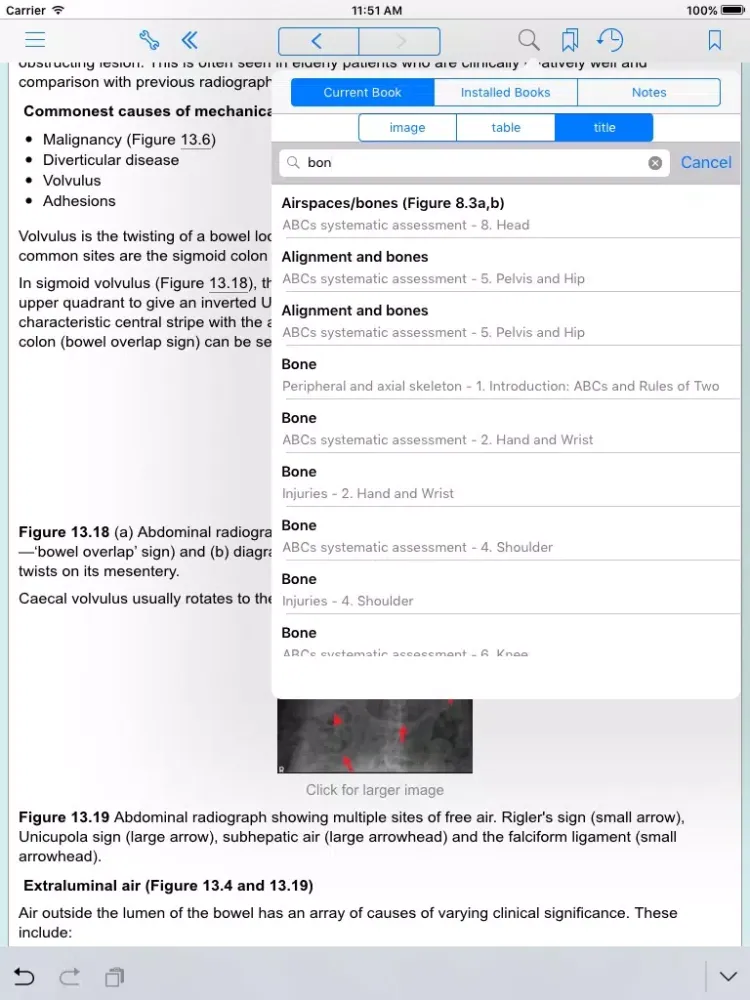 ABC of Emergency Radiology, 3rd Edition iPad  Screenshots