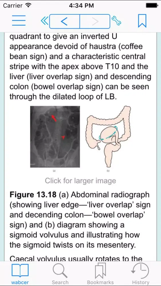 ABC of Emergency Radiology, 3rd Edition Screenshots