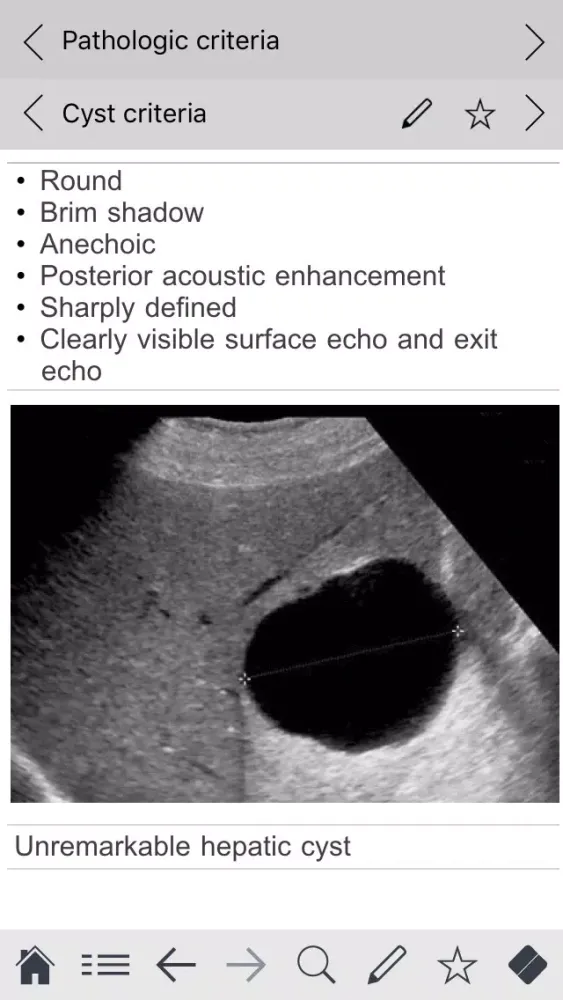 Captures d'écran de Abdominal ultrasound pocketcards