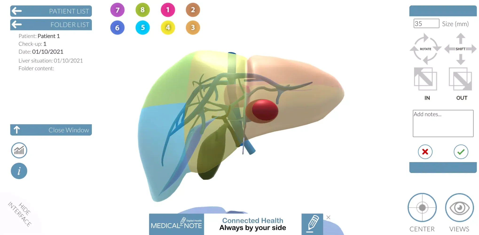 LIVER-NOTE Screenshots