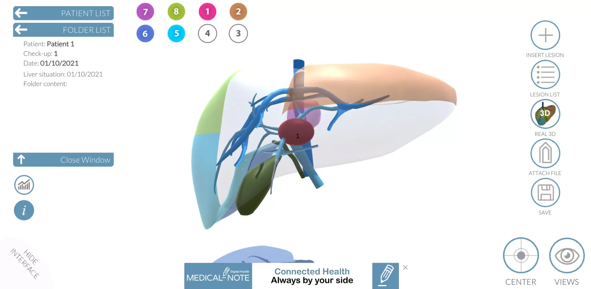 LIVER-NOTE Screenshots
