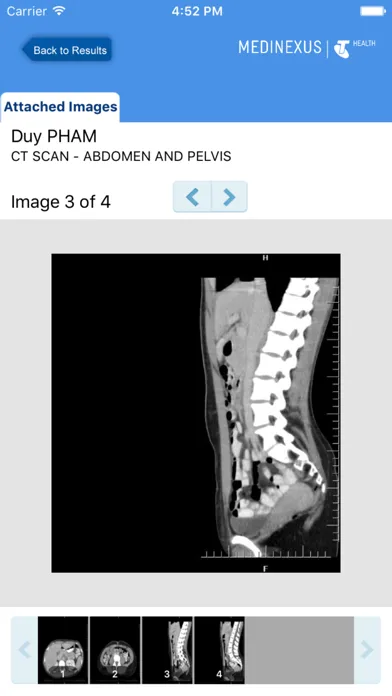 صور Medinexus Mobile for Patients