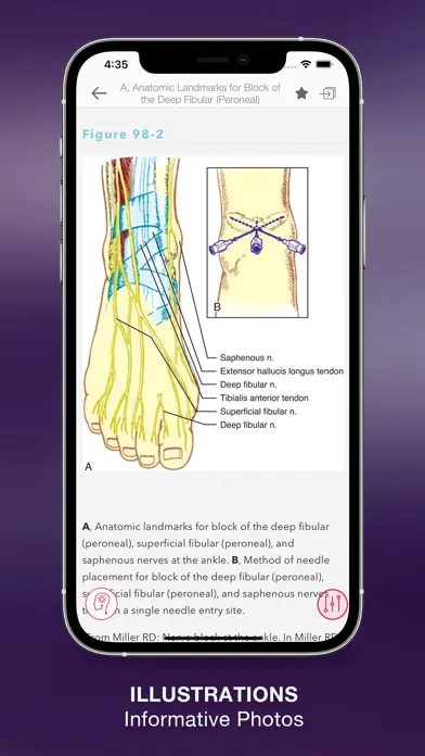 Faust's Anesthesiology Review スクリーンショット