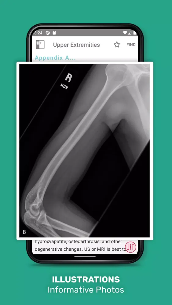 5 Min Sports Medicine Consult Screenshots