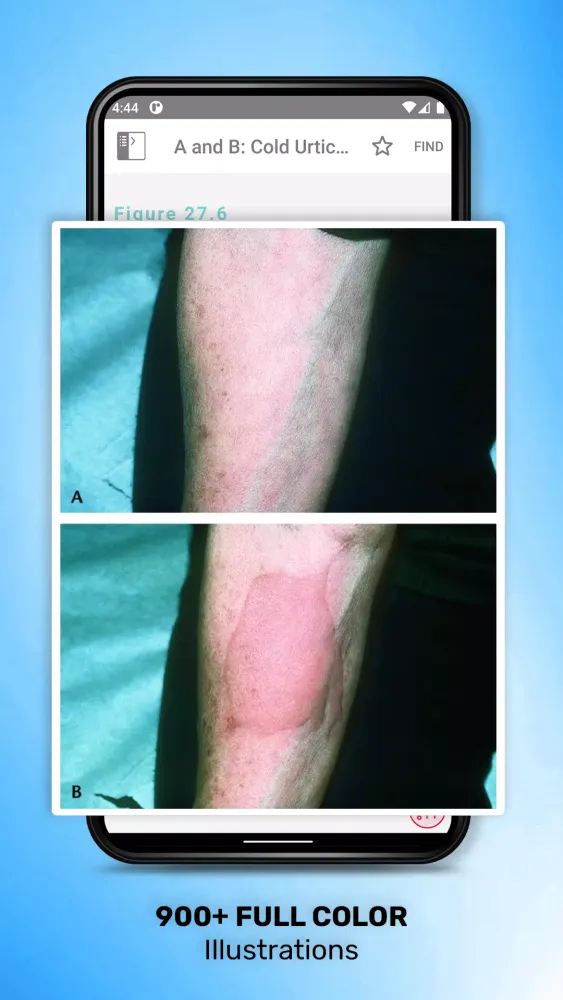 Pediatric Adult Skin Disorders Screenshots