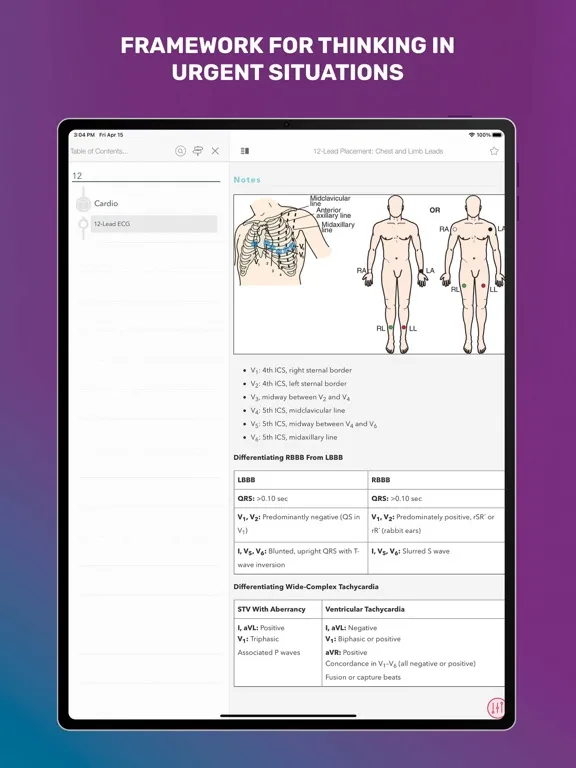 MedSurg Notes: Nurse Pkt Guide iPad  স্ক্রিনশট