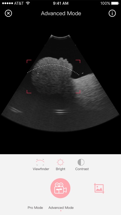 Fetus Camera Ekran Görüntüleri