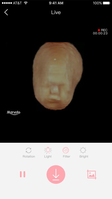 Fetus Camera Ekran Görüntüleri