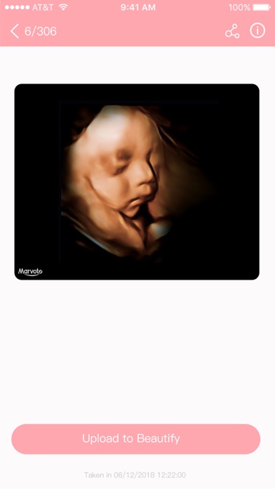 Fetus Camera Ekran Görüntüleri