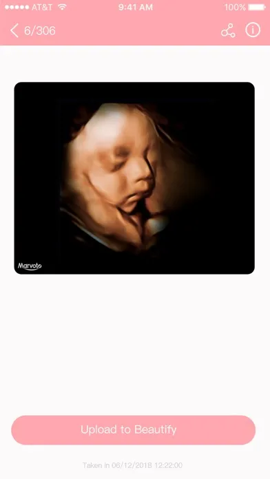 Fetus Camera Screenshots