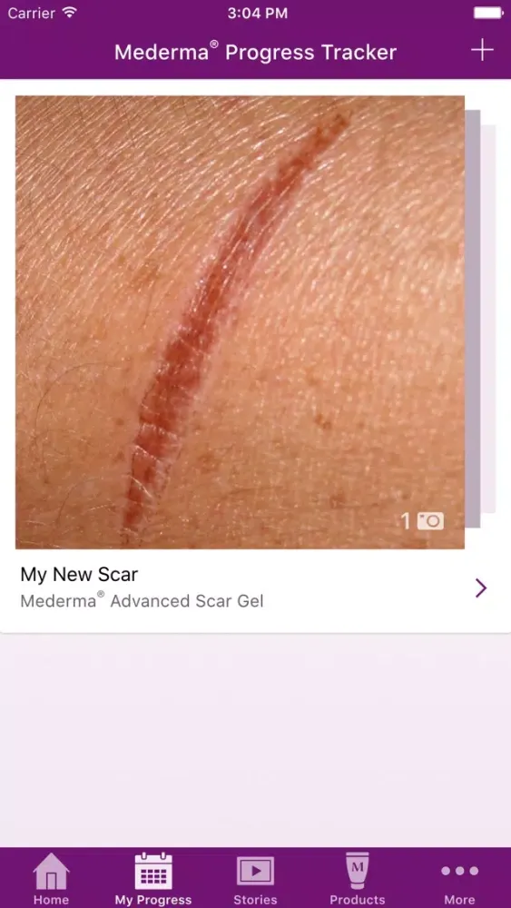 Capturas de tela do My Mederma