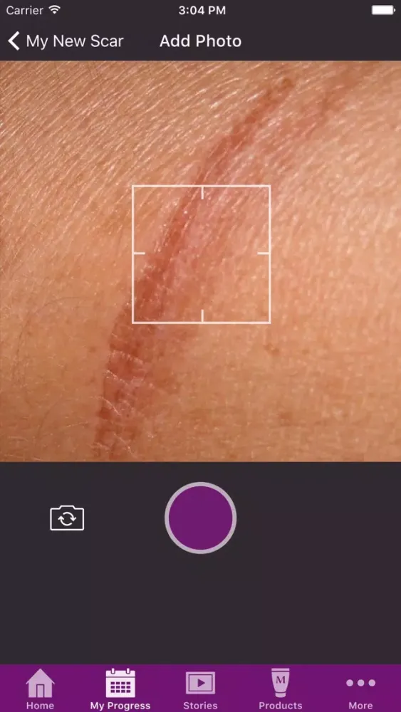 Capturas de tela do My Mederma