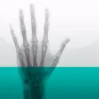Bone Age Lite