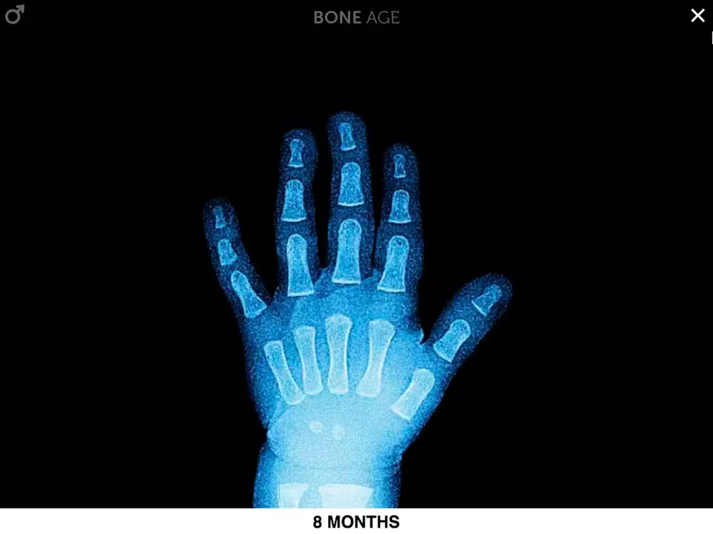 Скриншоты Bone Age Lite iPad 