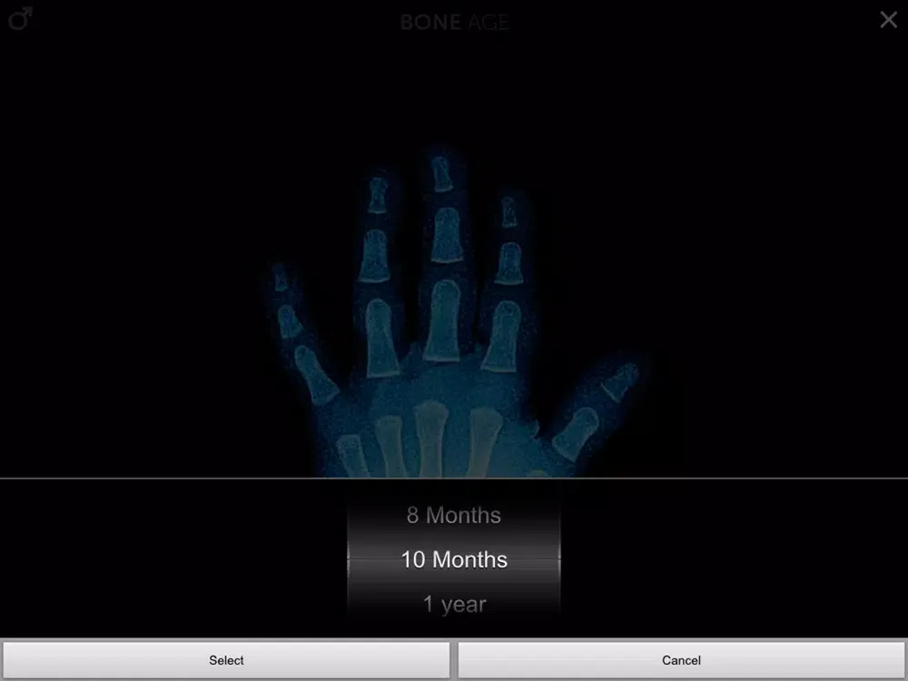 Скриншоты Bone Age Lite iPad 