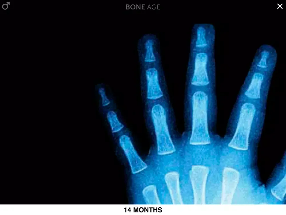 Скриншоты Bone Age Lite iPad 