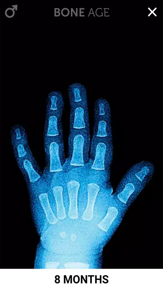 Скриншоты Bone Age Lite