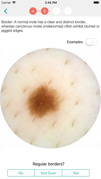 صور MoleScope™