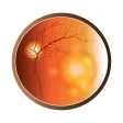 AMD & Anti-VEGF Therapy