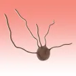 Medical Management of Melanoma Medical Management of Melanoma