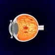 Understanding RVO