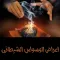 أعراض الوسواس الشيطاني