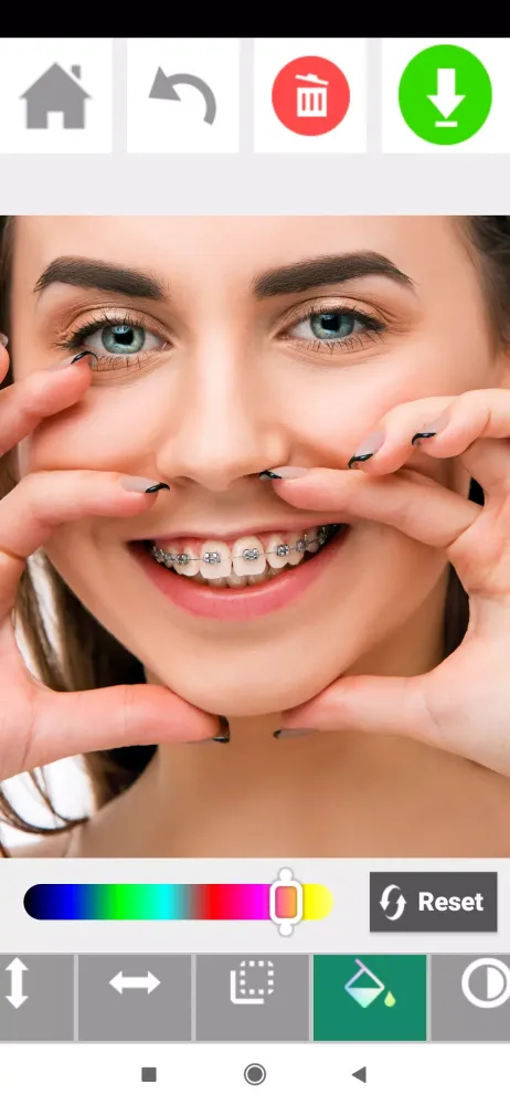 Capturas de pantalla de Braces on teeth: Photo editor