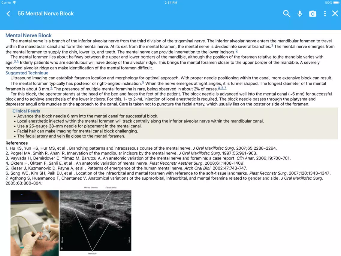 Capturas de pantalla de Ultrasound Anesthesia Atlas iPad 