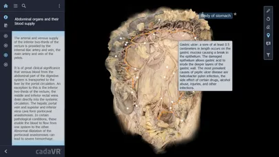 تصاویر cadaVR anatomy