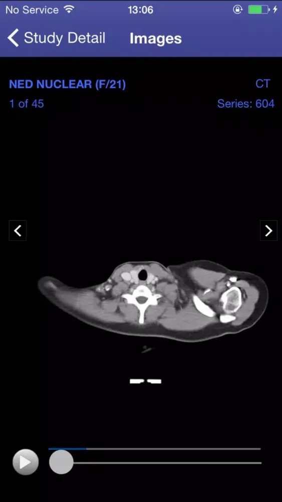 Vision Imaging 스크린샷