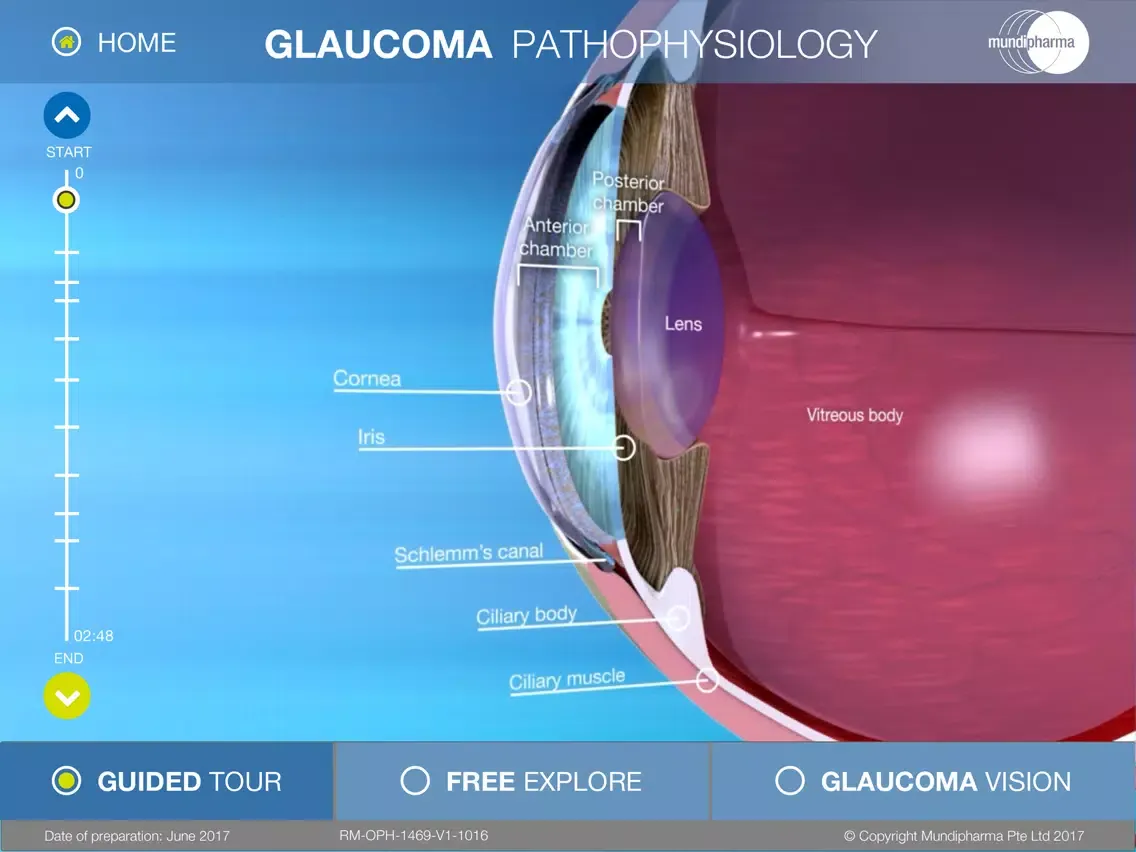 صور Glaucoma Education iPad 
