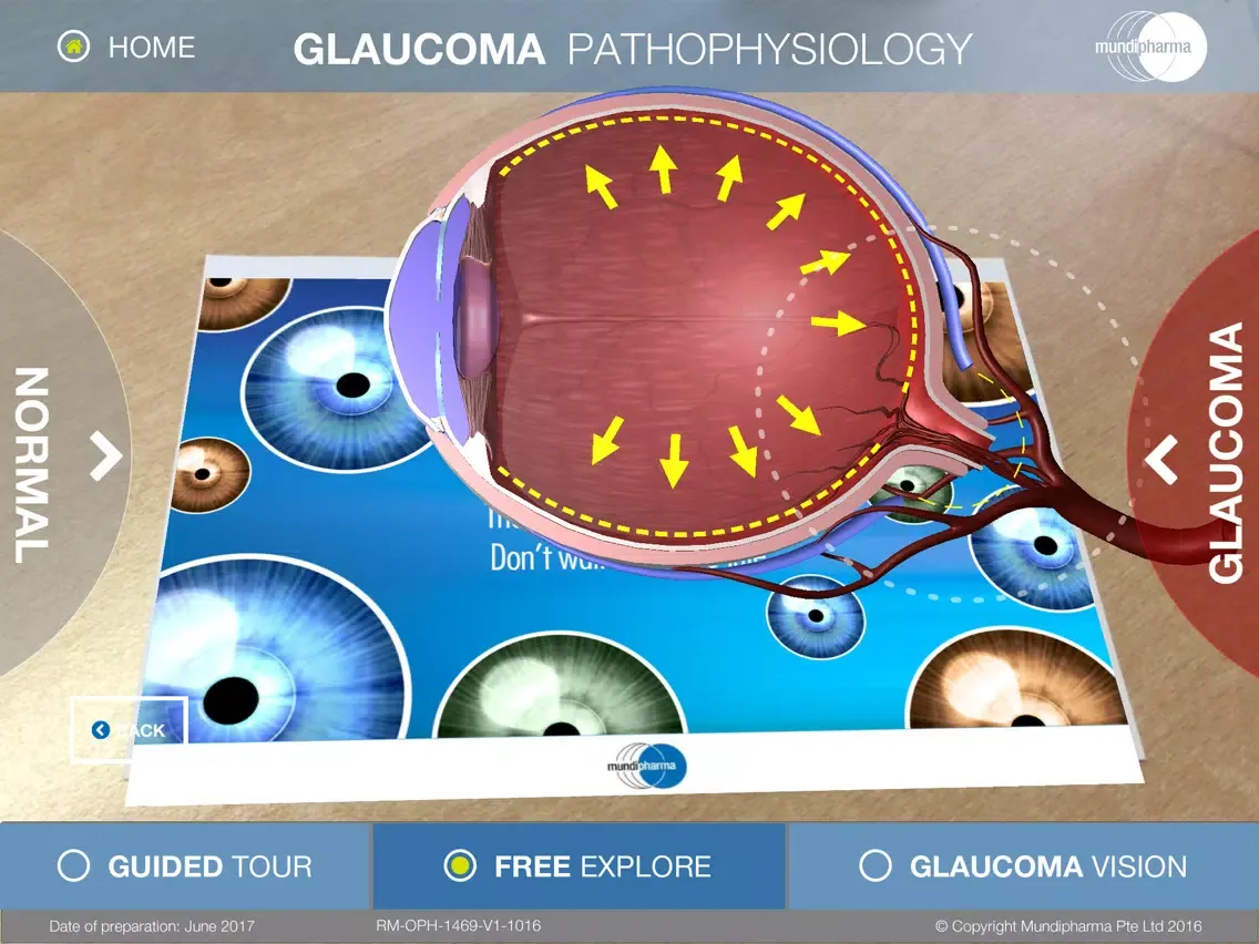صور Glaucoma Education iPad 