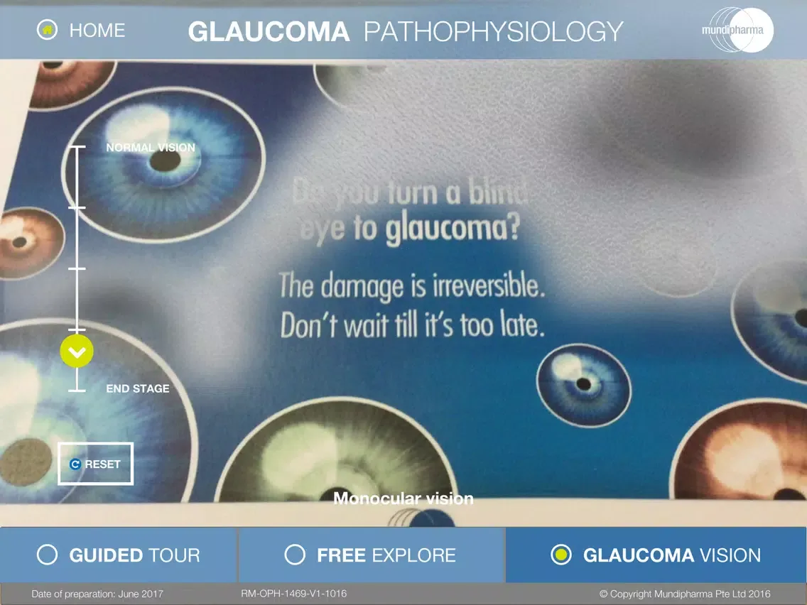 صور Glaucoma Education iPad 