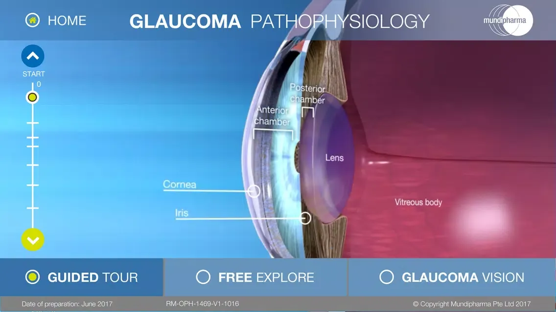 صور Glaucoma Education
