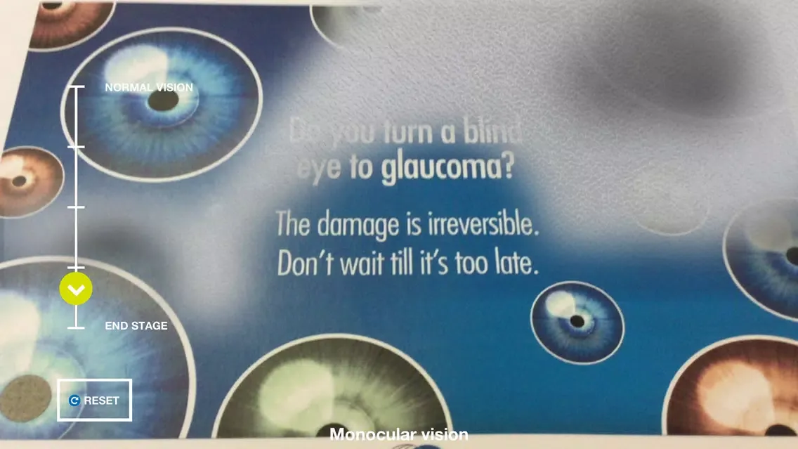صور Glaucoma Education