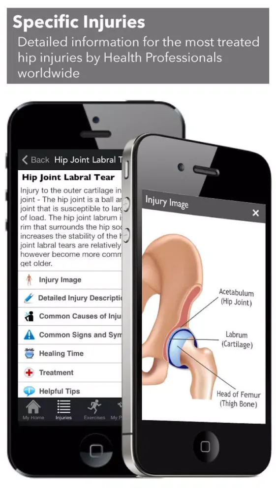 Tangkapan layar My Hip Injury