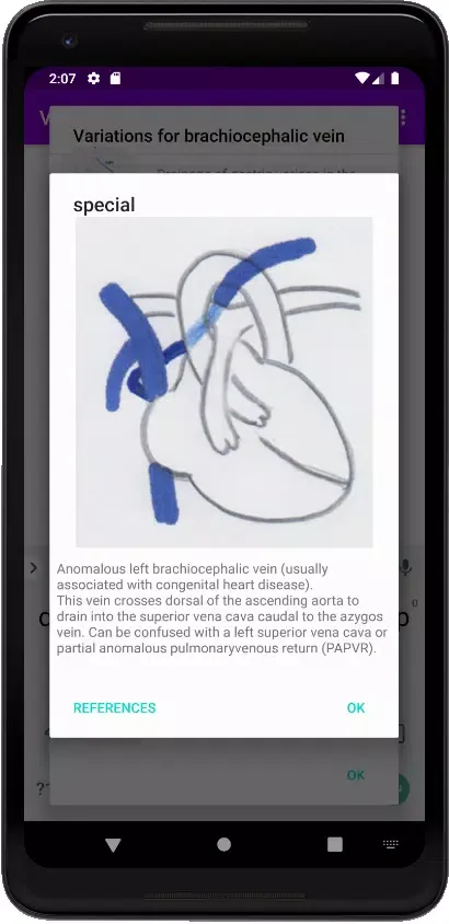 Screenshot di Vascular Variants
