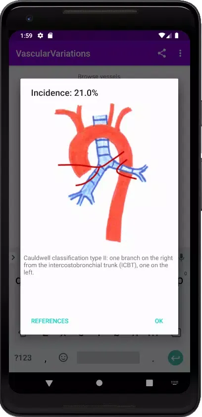 Screenshot di Vascular Variants