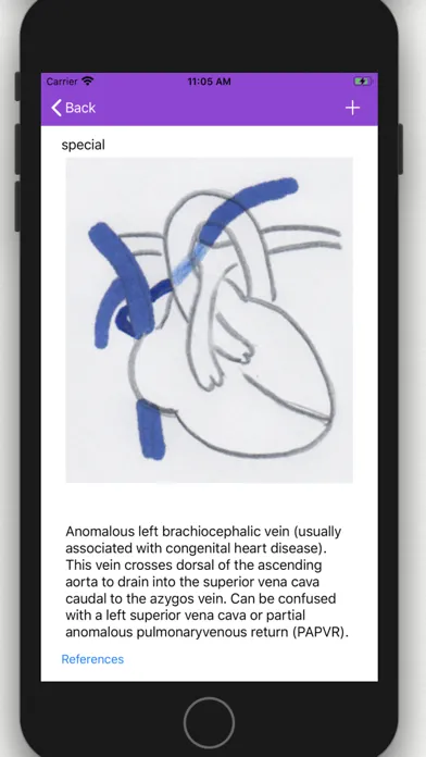 Vascular Variants应用截图