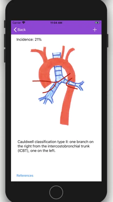 Vascular Variants应用截图